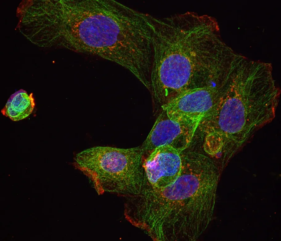 Confocal image of cells exposed to plastic particles