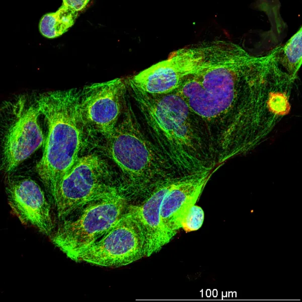 LPS + 50 nm nanoplastics — Confocal · 40× · LIGHTNING SVCC