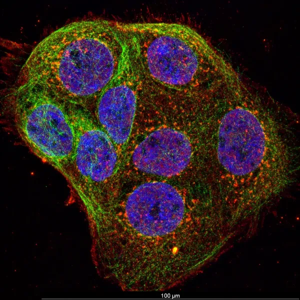 LPS + ATP — Confocal · 63× · LIGHTNING SVCC