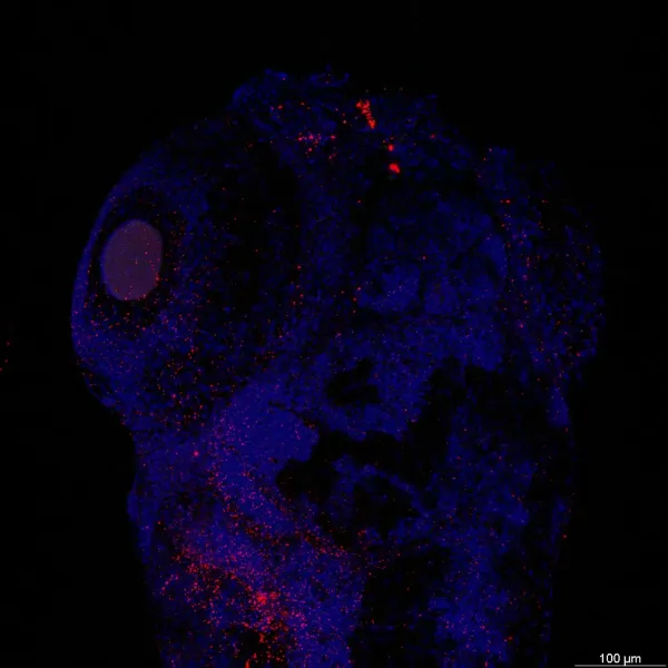 Larval imaging — Confocal · LIGHTNING LVCC