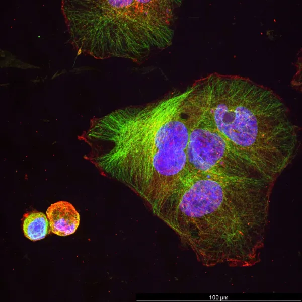 1 µm particles — Confocal · 40×